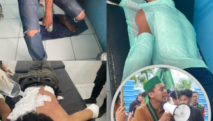 Aksi Damai Berujung Neraka : Tiga Kader HMI Kaltara Terbakar Saat Aksi, HMI Samarinda Mengecam Keras Tindakan Aparat